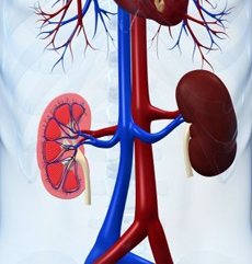 kidney problem